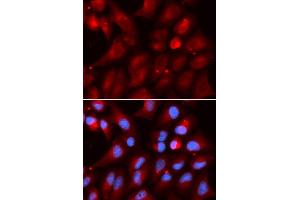 Immunofluorescence (IF) image for anti-Proteasome (Prosome, Macropain) Subunit, beta Type 2 (PSMB2) antibody (ABIN1876671) (PSMB2 抗体)