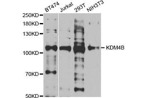 Western blot analysis of extracts of various cell lines, using KDM4B antibody (ABIN5973438) at 1/1000 dilution. (KDM4B 抗体)