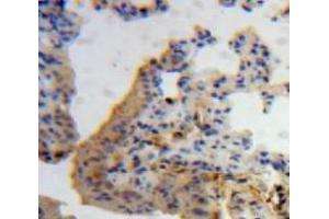 Used in DAB staining on fromalin fixed paraffin-embedded Lung tissue (IL-7 抗体  (AA 26-154))