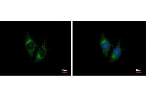 ICC/IF Image BNP antibody [N1C3] detects BNP protein at cytoplasm by immunofluorescent analysis. (NPPB 抗体)