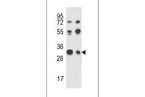 Western blot analysis of R Antibody (C-term) (ABIN651453 and ABIN2840247) in Jurkat,K562 cell line lysates (35 μg/lane). (TWIST Neighbor 抗体  (C-Term))