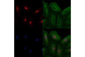 ABIN6260604 and ABIN6272502 staining  cells by IF/ICC. (CDK13 抗体  (Internal Region))