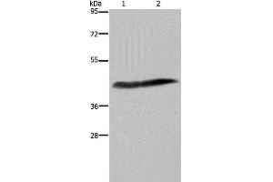 Western Blot analysis of Human placenta tissue and HepG2 cell using CD116 Polyclonal Antibody at dilution of 1:250 (CSF2RA 抗体)