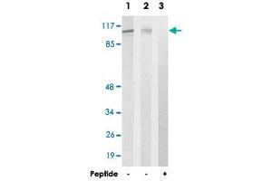 Western blot analysis of extracts from 293 cells (Lane 2) and HUVEC cells (Lane 1 and lane 3), using EFTUD2 polyclonal antibody . (EFTUD2 抗体)