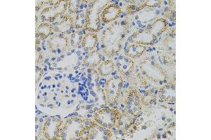 Immunohistochemistry of paraffin-embedded rat kidney using EPO antibody. (EPO 抗体)