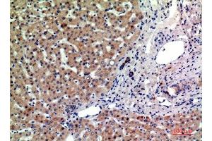 Immunohistochemical analysis of paraffin-embedded human-liver, antibody was diluted at 1:200