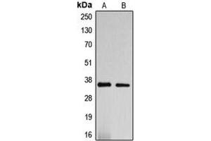Western blot analysis of DNAJC17 expression in HepG2 (A), SP2/0 (B) whole cell lysates. (DNAJC17 抗体  (N-Term))