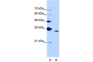 WB Suggested Anti-PPIE  Antibody Titration: 1. (PPIE 抗体  (Middle Region))