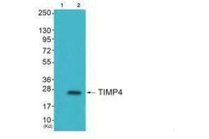 Western blot analysis of extracts from HepG2 cells (Lane 2), using TIMP4 antiobdy. (TIMP4 抗体  (C-Term))