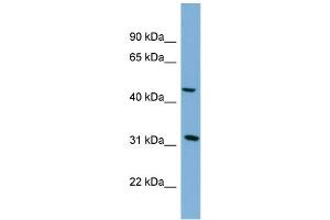 WB Suggested Anti-SERPINI2  Antibody Titration: 0.