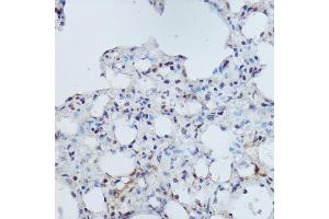 Immunohistochemistry of paraffin-embedded mouse lung using DDB1 Rabbit pAb (ABIN1679509, ABIN5664466, ABIN5664468 and ABIN6220382) at dilution of 1:350 (40x lens). (DDB1 抗体  (C-Term))