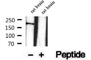 Western blot analysis of extracts of rat brain tissue, using Phospho-NMDAR2B (Ser1284) Antibody.