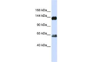 WB Suggested Anti-RAPGEF1 Antibody Titration: 0. (GRF2 抗体  (C-Term))