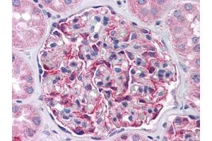 Human Kidney: Formalin-Fixed, Paraffin-Embedded (FFPE) (FRMPD4 抗体)