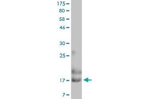Image no. 2 for Glycophorin A (GYPA) (AA 20-91) protein (His-DYKDDDDK-Strep II Tag) (ABIN5569858)