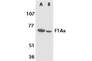 Western blot analysis of F1A alpha in mouse (A) and rat (B) liver tissue lysates with AP30325PU-N F1A alpha antibody at 1 μg/ml. (FEM1B 抗体  (C-Term))