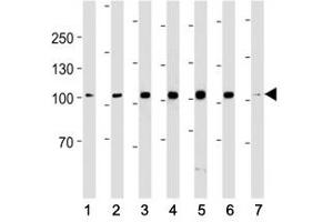 Western Blotting (WB) image for anti-Angiotensin I Converting Enzyme 2 (ACE2) antibody (ABIN3029964)