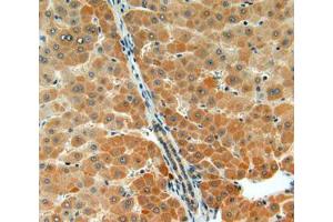 IHC-P analysis of liver tissue, with DAB staining. (Acetylcholinesterase 抗体  (AA 366-554))