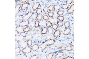 Immunohistochemistry of paraffin-embedded Mouse kidney using EPN1 Rabbit pAb (ABIN7267000) at dilution of 1:100 (40x lens). (Epsin 1 抗体  (AA 130-180))