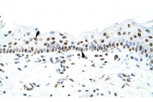 SFPQ antibody was used for immunohistochemistry at a concentration of 4-8 ug/ml to stain Squamous epithelial cells (arrows) in Human Skin. (SFPQ 抗体)