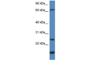 WB Suggested Anti-GSTM5 Antibody Titration:  0. (GSTM5 抗体  (N-Term))