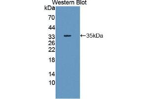 Western blot analysis of the recombinant protein. (SHP1 抗体  (AA 244-515))