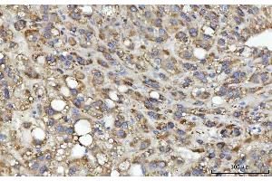 IHC analysis of MSF/SEPTIN9 using anti-MSF/SEPTIN9 antibody (ABIN7600104). (Septin 9 抗体  (AA 15-282))