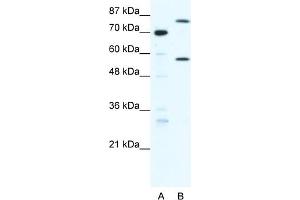 WB Suggested Anti-MYNN Antibody Titration:  1. (Myoneurin 抗体  (Middle Region))