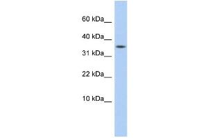WB Suggested Anti-DYSFIP1 Antibody Titration: 0. (PPP1R27 抗体  (Middle Region))