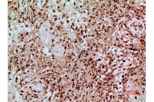 Immunohistochemistry (IHC) analysis of paraffin-embedded Human Brain, antibody was diluted at 1:100. (SAMHD1 抗体  (Internal Region))