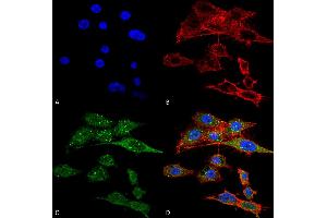 Immunocytochemistry/Immunofluorescence analysis using Rabbit Anti-Rubicon Polyclonal Antibody . (Rubicon 抗体  (N-Term) (HRP))