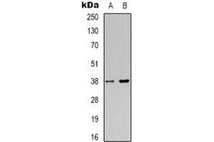 Western blot analysis of NDRG4 expression in Jurkat (A), HepG2 (B) whole cell lysates. (NDRG4 抗体)
