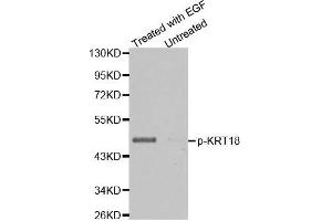 Western blot analysis of extracts from HT29 cells untreated or treated with EGF using Phospho-KRT18-S33 antibody. (Cytokeratin 18 抗体  (pSer33))