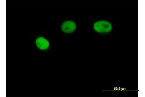 Immunofluorescence of purified MaxPab antibody to PSMB7 on HeLa cell.