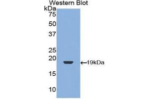 Western Blotting (WB) image for anti-Transforming Growth Factor, beta 1 (TGFB1) (AA 279-390) antibody (ABIN3209254) (TGFB1 抗体  (AA 279-390))