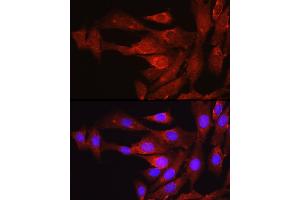 Immunofluorescence analysis of NIH/3T3 cells using Proprotein Convertase 9(PCSK9) Rabbit pAb (ABIN6133851, ABIN6145328, ABIN6145330 and ABIN6223837) at dilution of 1:250 (40x lens).
