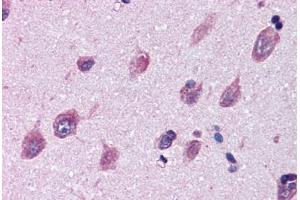 Brain, cortex, Human: Formalin-Fixed, Paraffin-Embedded (FFPE) (IGSF8 抗体  (Internal Region))