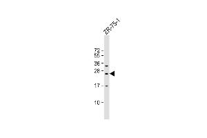 Anti-KLRF2 Antibody (N-term) at 1:1000 dilution + ZR-75-1 whole cell lysate Lysates/proteins at 20 μg per lane. (KLRF2 抗体  (N-Term))