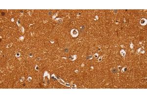 Immunohistochemistry of paraffin-embedded Human brain tissue using TNFRSF8 Polyclonal Antibody at dilution 1:60 (TNFRSF8 抗体)