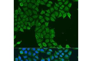 Immunofluorescence analysis of U2OS cells using CDK16 Polyclonal Antibody at dilution of 1:100. (CDK16 抗体)