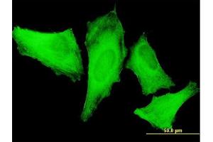 Immunofluorescence of monoclonal antibody to MYH9 on HeLa cell. (Myosin 9 抗体  (AA 131-220))