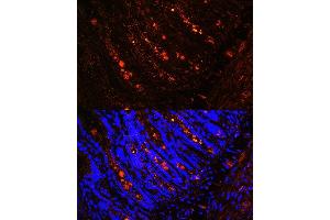 Immunofluorescence (IF) image for anti-Intelectin 1 (Galactofuranose Binding) (ITLN1) (AA 19-313) antibody (ABIN6142601)