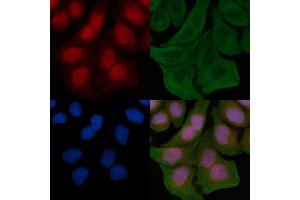 ABIN6259633 and ABIN6275638 staining Hela cells by IF/ICC.