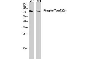 Western Blot (WB) analysis of VEC 293 lysis using Phospho-Tau (T205) antibody. (tau 抗体  (pThr205))