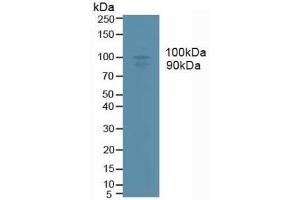 Detection of ADAM17 in Human U937 Cells using Monoclonal Antibody to A Disintegrin And Metalloprotease 17 (ADAM17) (ADAM17 抗体  (AA 226-473))