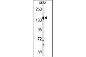 Image no. 2 for anti-Phosphoinositide-3-Kinase, Catalytic, gamma Polypeptide (PIK3CG) (AA 1073-1102), (C-Term) antibody (ABIN360452)
