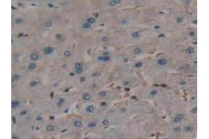 Detection of TL1A in Human Liver Tissue using Polyclonal Antibody to TNF Like Ligand 1A (TL1A) (TNF Like Ligand 1A (AA 67-251) 抗体)