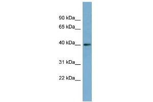 WB Suggested Anti-RP2 Antibody Titration: 0. (RP2 抗体  (Middle Region))