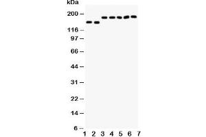 Western blot testing of DCC antibody and Lane 1:  rat brain;  2: mouse brain;  and human samples 3: U87;  4: SW620;  5: COLO320;  6: 293T;  7: HeLa cell lysate. (DCC 抗体  (AA 162-178))