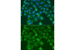 Immunofluorescence analysis of A549 cells using CST1 antibody (ABIN6293854). (CST1 抗体)